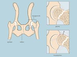 heupdysplasie hond